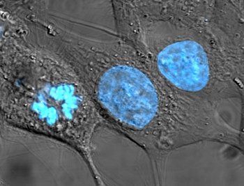 1008-HeLa_cells_stained_with_Hoechst_33258